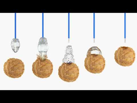 Holmium laser Quanta System