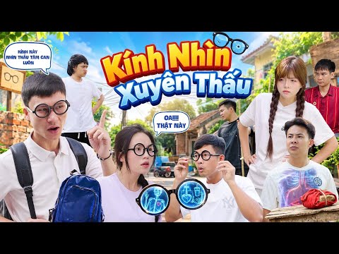 KÍNH NHÌN XUYÊN THẤU | Hai Anh Em Phần 1181 | Tình Huống Hài Hước