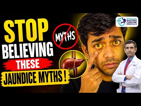 STOP Believing These Jaundice Myths! | Jaundice Facts Everyone Must Know