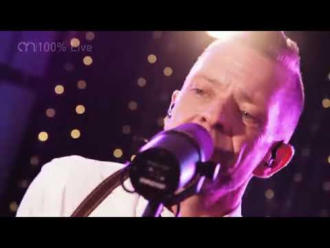 The Dukes performing Sex On Fire live in session   AliveNetwork