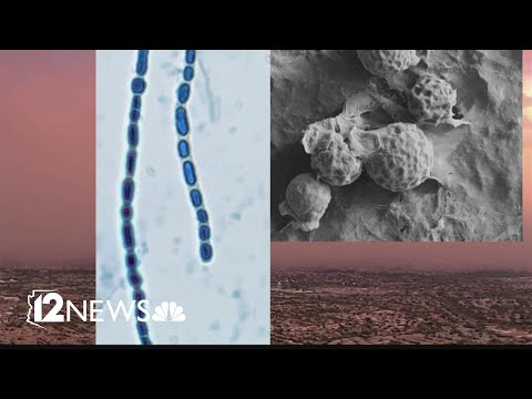 Here’s what you need to know about Arizona’s Valley fever