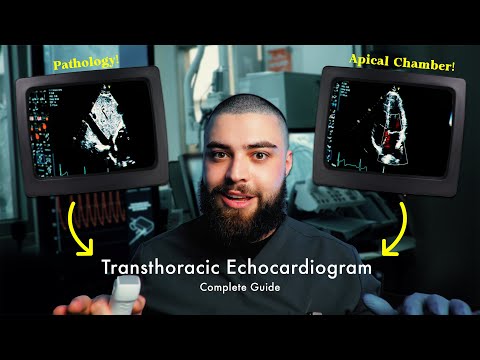 How to Perform a Transthoracic Echocardiogram (TTE) | Step-by-Step Guide!