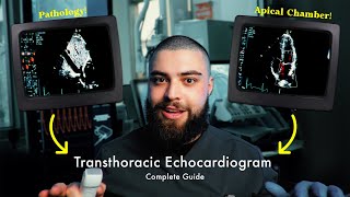 How to Perform a Transthoracic Echocardiogram (TTE) | Step-by-Step Guide!