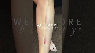 Body Coverage Perfector - Transfer-Resistant, Waterproof &amp; Lasts for Days