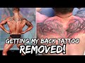 GETTING MY BACK TATTOO REMOVED | Operation 2022 | Episode 13
