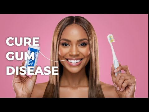 Cure Gum Disease Naturally (A Complete Guide)