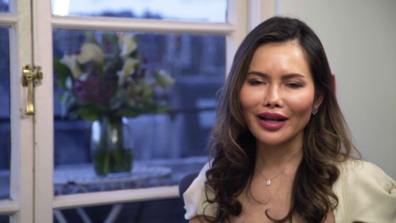 Non -Surgical Rhinoplasty Treatment