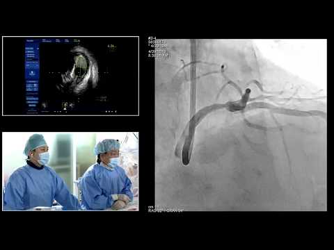 [TCTAP 2019] Coronary Symposium - Live Case & Lecture Session II