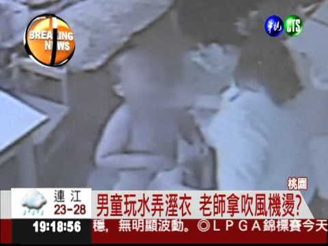 幼稚園虐童?! 4歲童遭吹風機燙傷