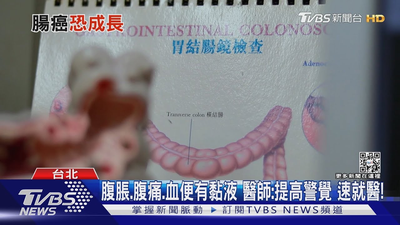 疫情期間!民眾「沒做這件事」 醫界憂心腸癌人數恐增加!