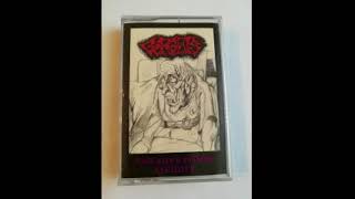 Gorguts - ...And Then Comes Lividity (rare 1990 demo)