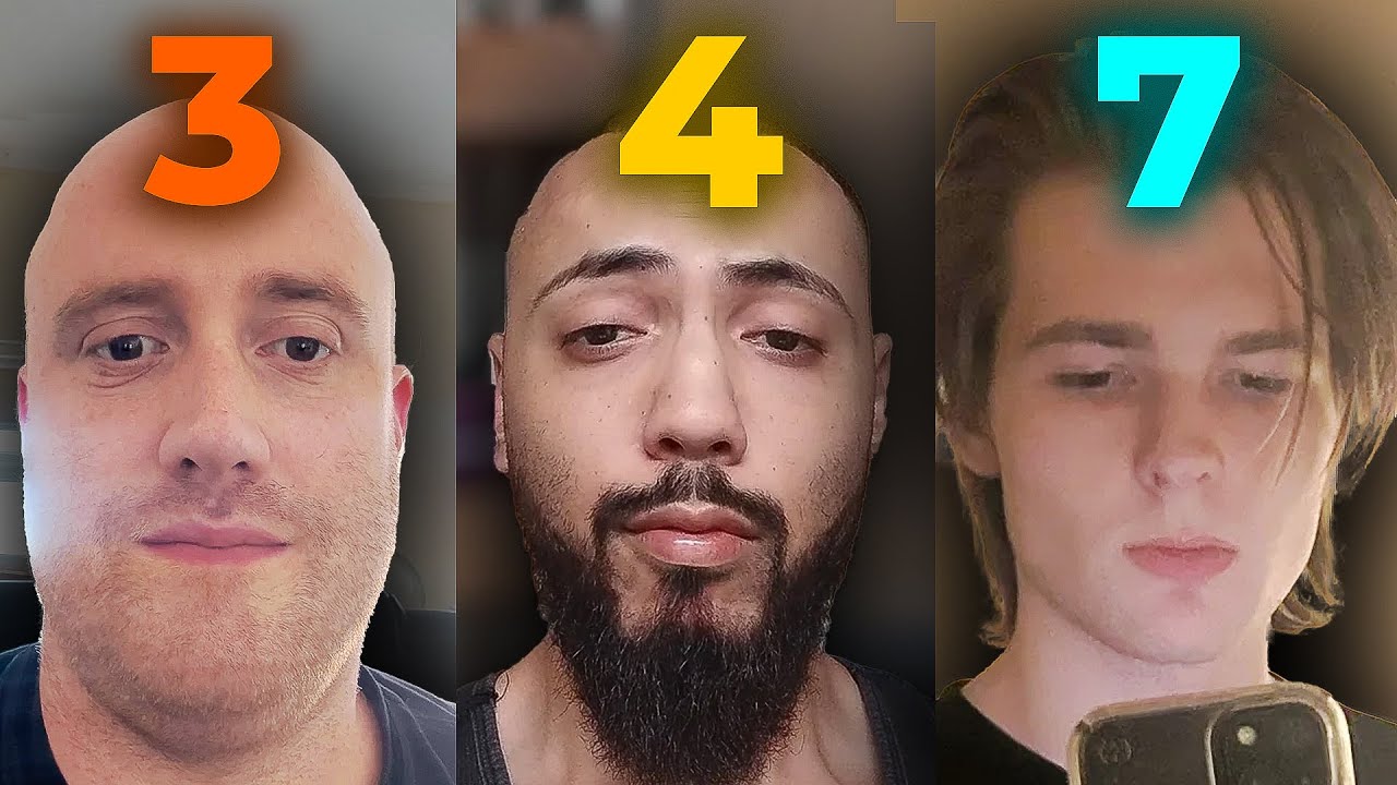Face Rating + Looksmaxxing Reddit Faces (Brutally Honest)