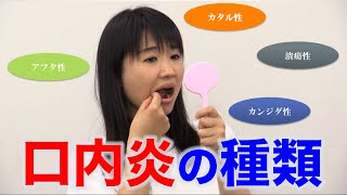 いろいろある？　口内炎の種類