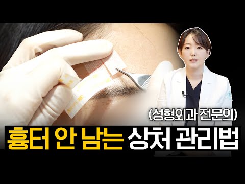 성형외과 전문의가 알려주는 흉터 안 남는 상처 관리법!