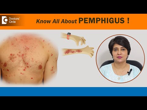 Plaies et cloques douloureuses sur la peau – Symptômes et traitement du pemphigus ? – Dr Rasya Di...