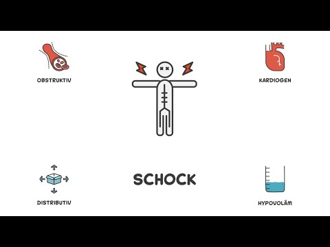 Schock