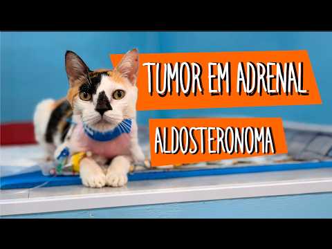 Tumor em Adrenal: Aldosteronoma