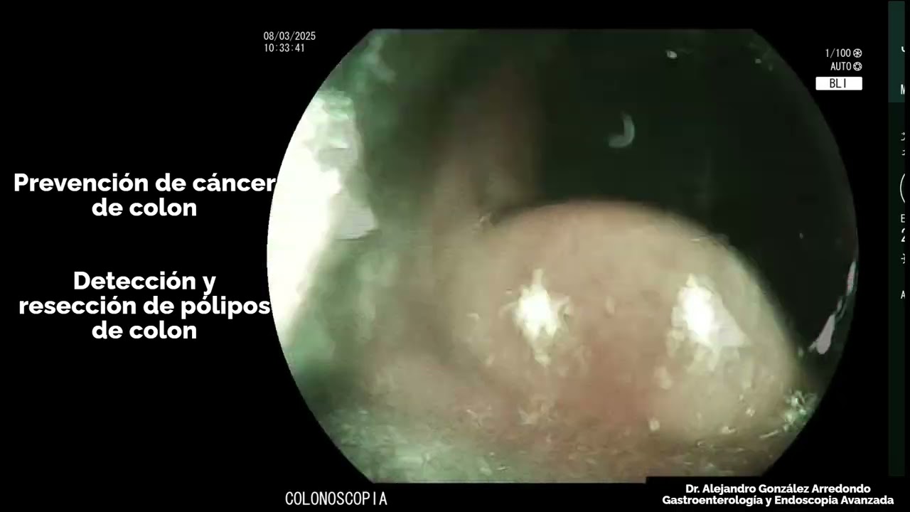 Alejandro Gonzalez Arredondo-3