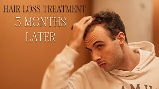 3 MONTH UPDATE: HAIR LOSS TREATMENT (2/4)