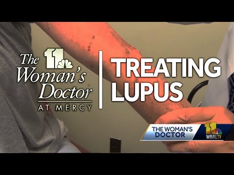 Recognize the symptoms: Fatigue, rashes can point to lupus