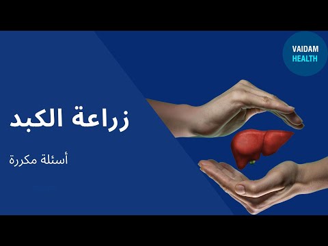 الأسئلة المتداولة حول زراعة الكبد