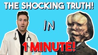 Doctor Reveals The REAL Elephant Man!