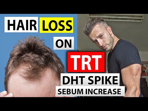 Testosterone and Hair Loss | TRT and DHT spike | Is Big 3 Enough to Save Hair on TRT?