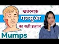 Home Remedies for Mumps : गले की सूजन या गलसुआ के घरेलू उपाय | क