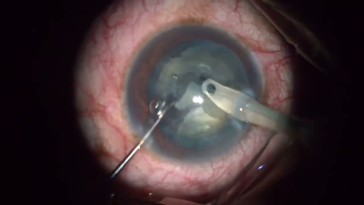 Pablo Alexis Limon Zurita-5