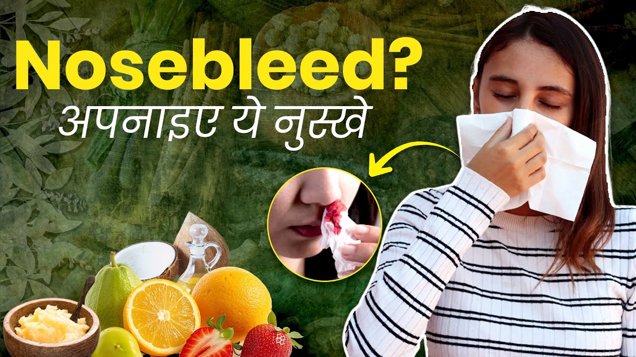 Nosebleed 5 I Aasan Nuskhe Behtar Zindagi