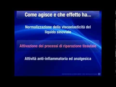 Cifosi toracica lisciò cosa significa Trattamento della cervicale degenerative farmaci malattie disco e unguenti