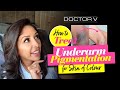 Doctor V How To Treat Underarm Pigmentation For Skin Of Colour Brown Or Black Skin