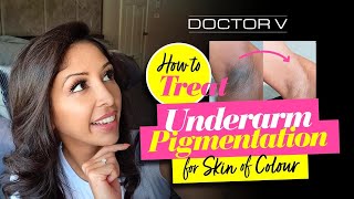Doctor V - How To Treat Underarm pigmentation For Skin Of Colour | Brown Or Black Skin