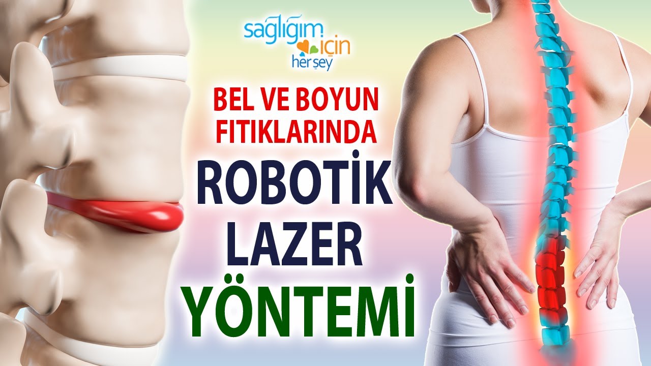 Bel ve Boyun Fıtıklarında Robotik Lazerin Önemi