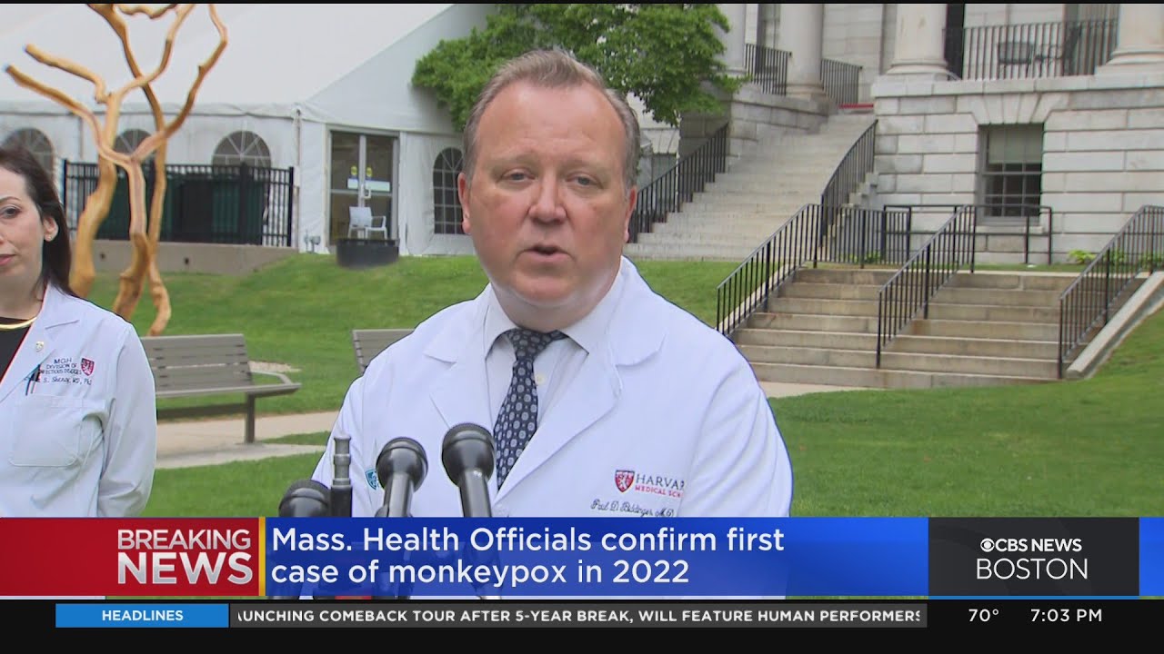 MGH doctors provide update on monkeypox case