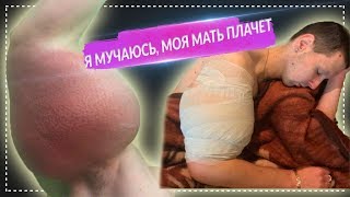 Руки-базуки опухли в 2 раза, Терешин попрощался с подписчиками "Я мучаюсь, моя мать плачет".