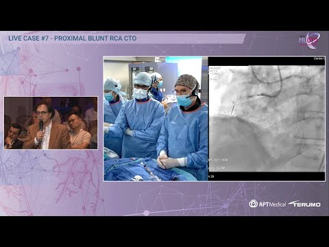 Proximal Blunt RCA CTO - MLCTO 2023