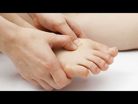 Singit fungus ekzoderil Tadyang kuko paggamot
