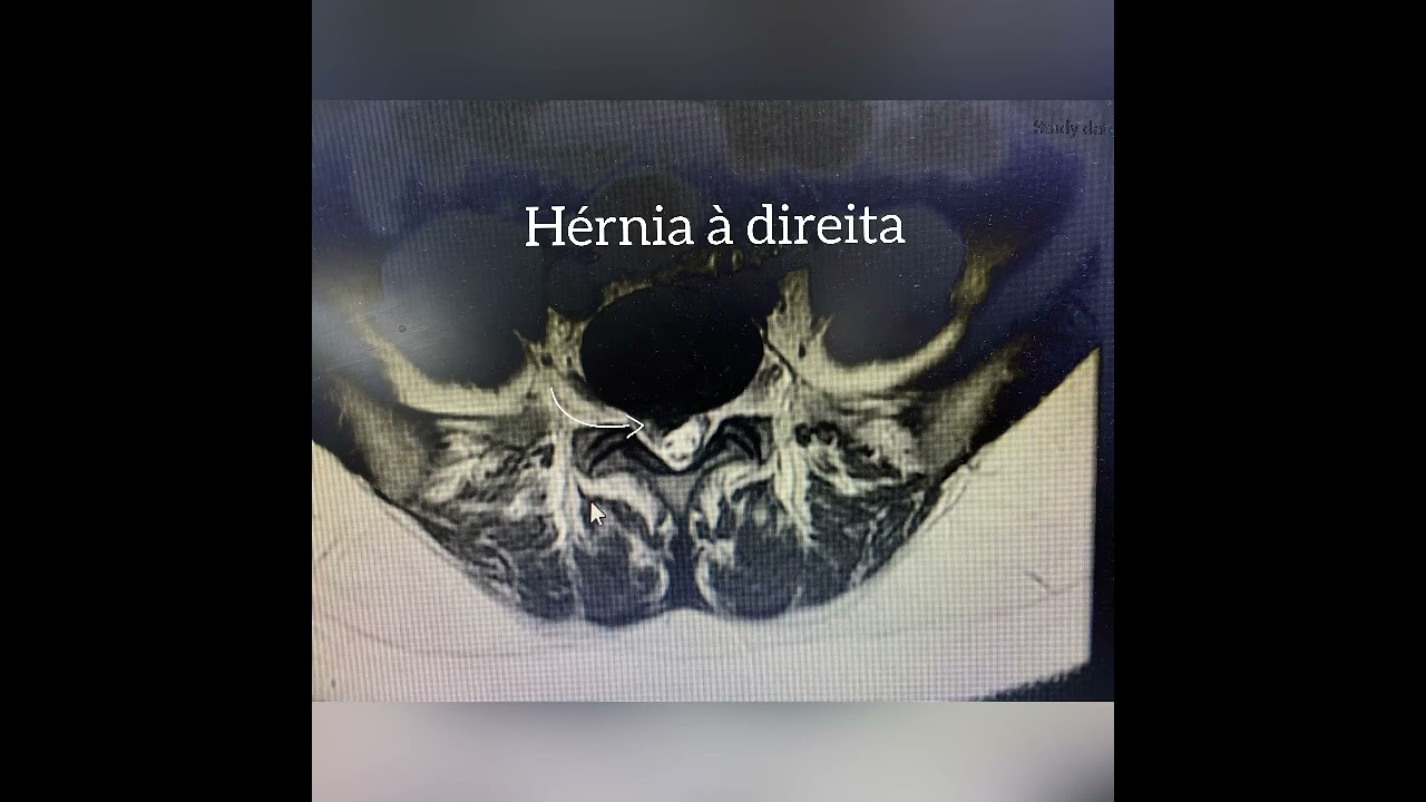 José Lopes Sousa Filho-91