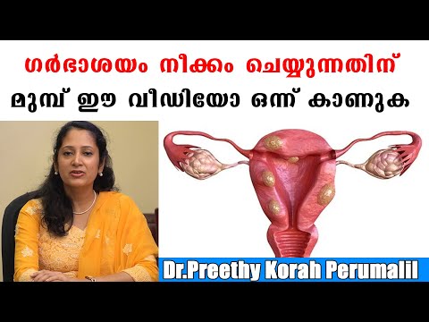 ഗർഭാശയം നീക്കം ചെയ്യേണ്ടി വരുന്നതിന് മുമ്പ് ഈ വീഡിയോ നിർബന്ധമായും കാണുക