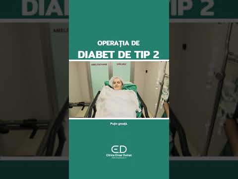 Operația de diabet de tip 2 prezentată de la A la Z, de la plecare și până la revenirea în țară.