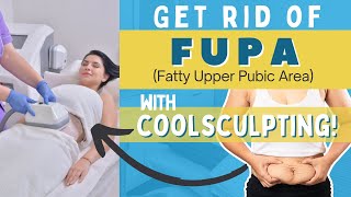 Do you have a Fatty Upper Pubic Area (FUPA)? CoolSculpting might be your answer!
