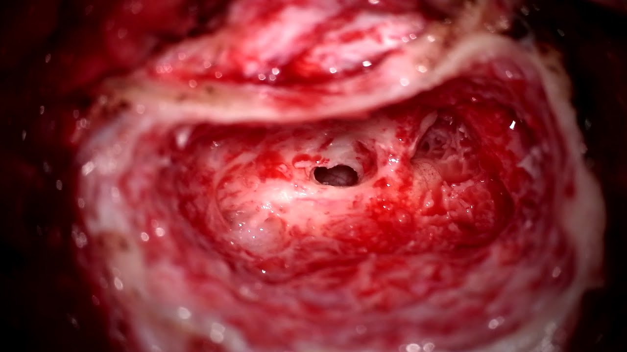 Rubén Polo López-12