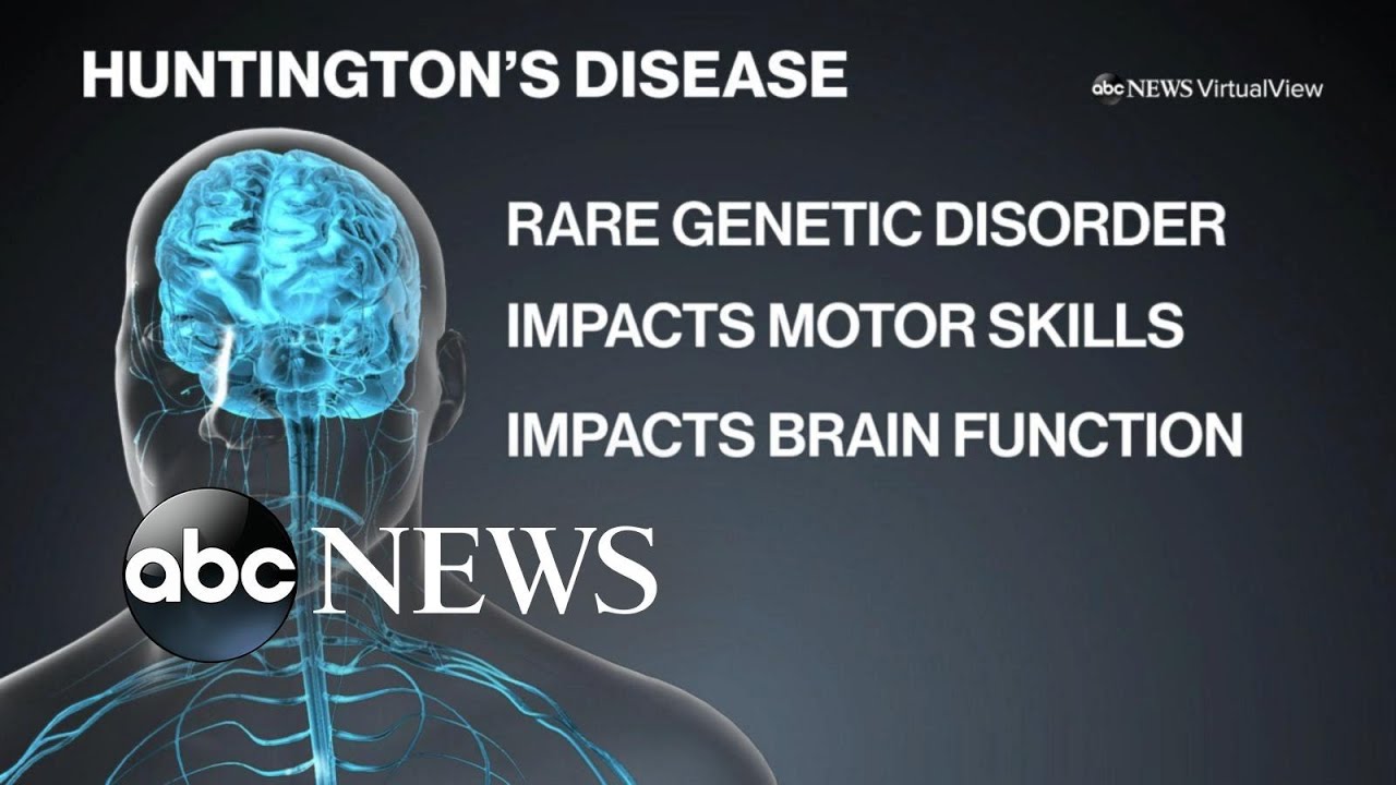 Living with Huntington’s disease