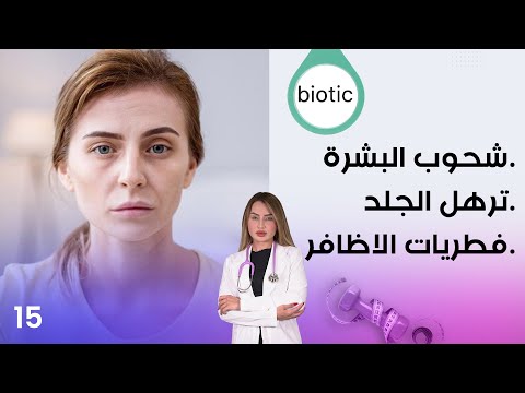 شاهد بالفيديو.. شحوب البشرة، ترهل الجلد، فطريات الاظافر - م٣ Biotic - الحلقة ١٥