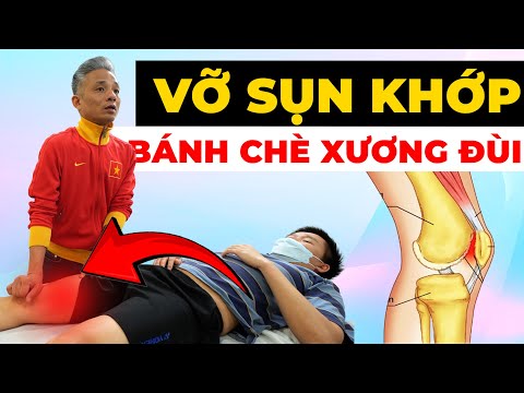 Đừng Chủ Quan Với Vỡ Sụn Khớp Bánh Chè – Ác Mộng Khi Bước Xuống Cầu Thang!
