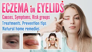 Eczema on Eyelids Causes, Symptoms, Risk factors, Treatment, Prevention and Home Remedies Options