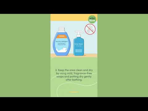 How To Stop Itching Down There Immediately