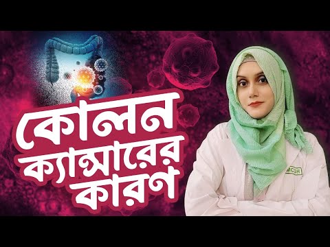 যে কারণে তরুণদের মধ্যে বাড়ছে কোলন ক্যান্সার