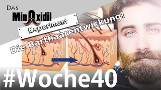 Das Minoxidil Experiment #Woche40 Wie entwickelt sich ein Barthaar?